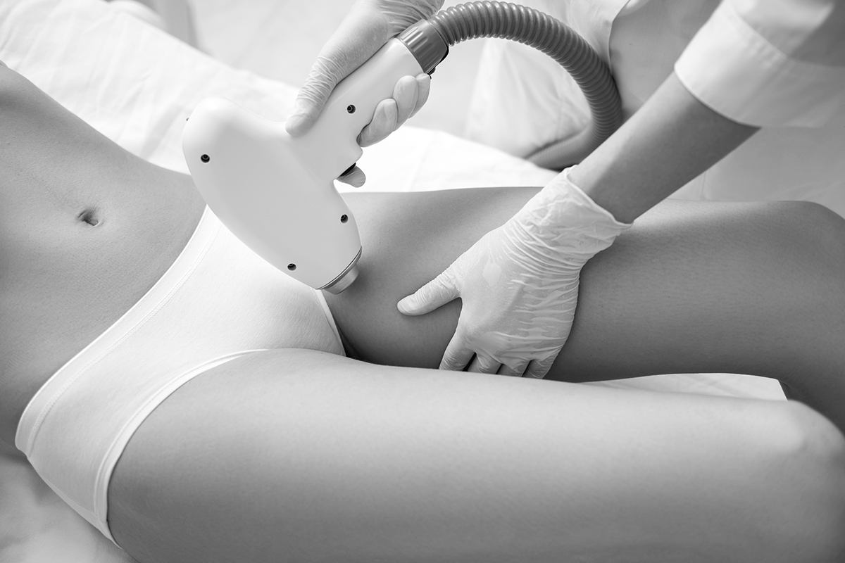 A woman receiving laser hair removal in Gloucester County